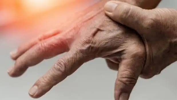 اسپاستیسیتی یا سفتی غیرطبیعی عضلات و نقش فیزیوتراپی در بهبود حرکت بیمار