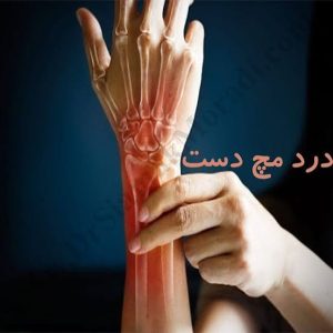 درد مچ دست چیست و فیزیوتراپی چه نقشی در کاهش درد و بهبود عملکرد دست دارد