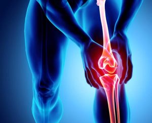 زانودرد هنگام بالا رفتن از پله و نقش فیزیوتراپی در کاهش درد و بهبود عملکرد زانو