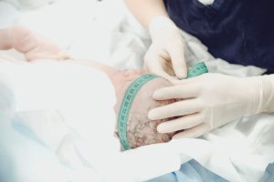 تصویر نوزادان مبتلا به هیدروسفالی و میکروسفالی و مداخلات درمانی زودهنگام
